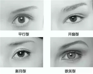 昆明美莱<a href='//m.roanokegop.com/www/ybzx/syp/' target='_blank'><u>割双眼皮</u></a>有哪些类型