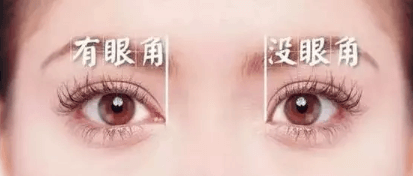 <a href='//m.roanokegop.com/www/cqhm/' target='_blank'><u>重庆华美</u></a>开眼角手术需要多少钱