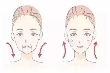 同样是填充玻尿酸，效果为什么不同