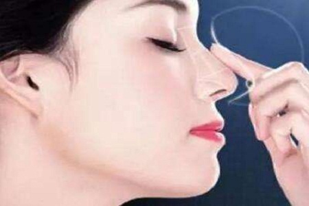 苏州做假体隆鼻失败修复多少钱