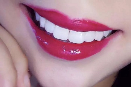 <a href='//m.roanokegop.com/www/wzhm/' target='_blank'><u>万州华美</u></a>冷光美白牙齿多少钱